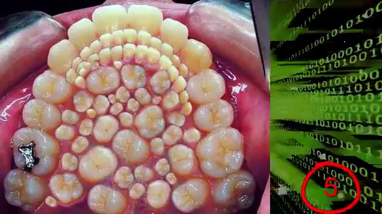 7 Freaky Medical Conditions_3عذاب الہی کی ایک جہلک ضرور دیکھیں