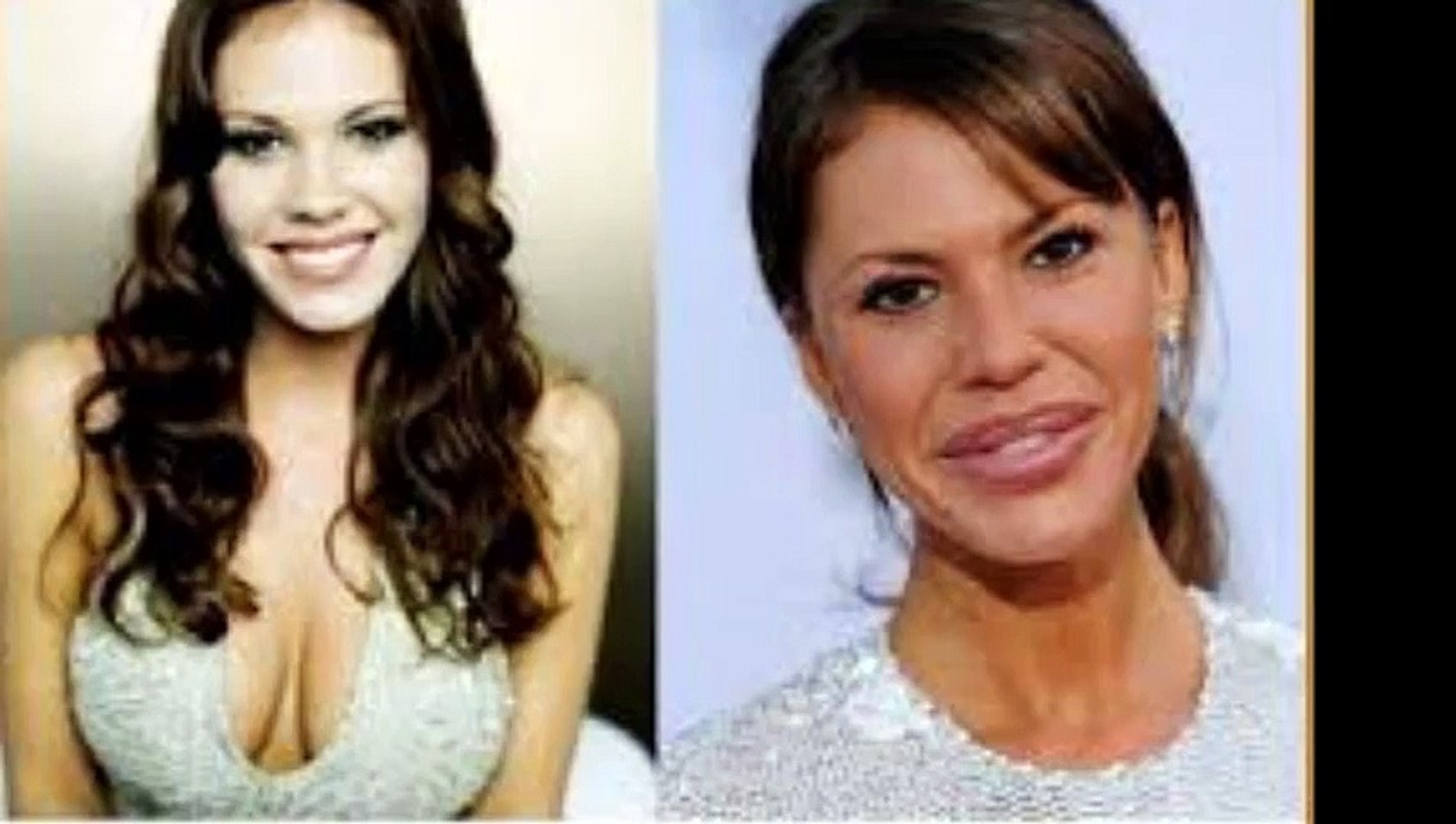 ⁣plastic surgery fail