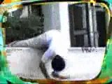 Skater Breaks His Arm