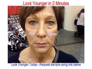 Hala Koudsi Dermatologist Reviews in CA