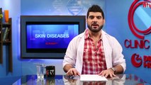 Gosht Se Allergy  - Clinic Online - HTV
