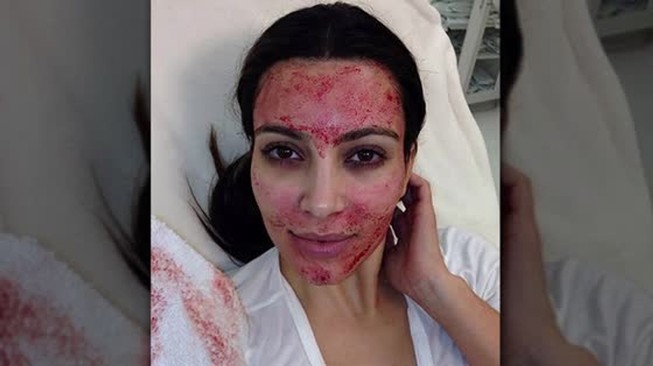 Die Top 5 sonderbar & wunderbar Behandlungen der Promis