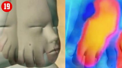 Fazla Organla Doğan 20 İlginç İnsan