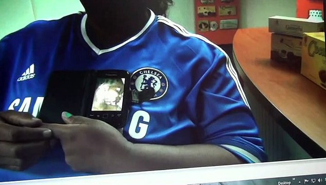 016 Primus stove exploded in her face- burns on the face, eye lid, chest and upper arm- completely healed in 2 weeks