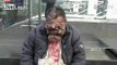 Man with scary tumors in face begs in street