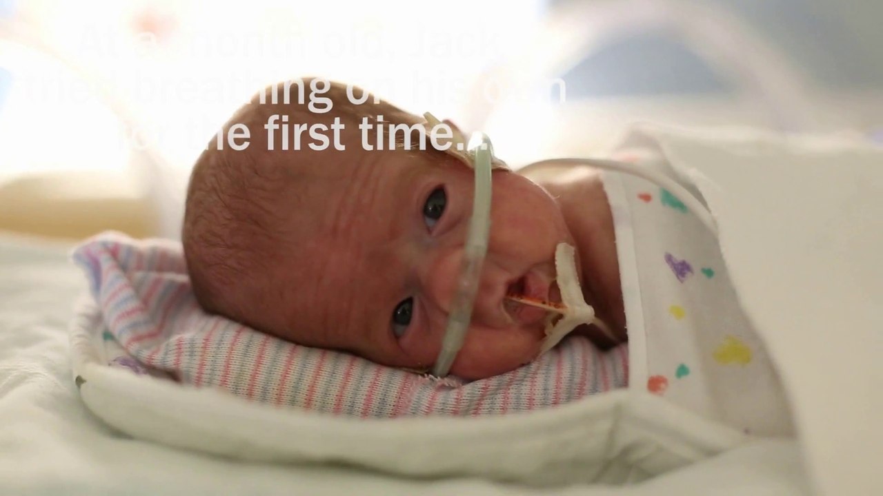 Un papa fête l'anniversaire de son bébé prématuré de 1 an! Trop émouvant!