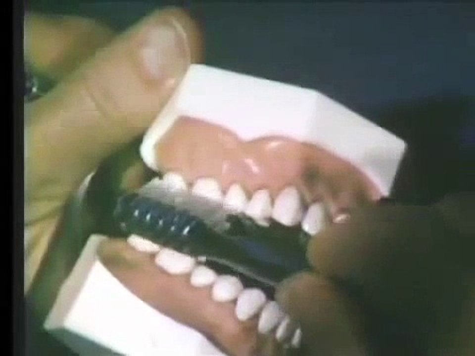Flossing Technique - Oral Hygiene Instructions by Dr. Berdy, periodontist Jacksonville, FL