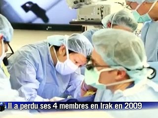 Etats-Unis: un soldat greffé des deux bras veut refaire du sport