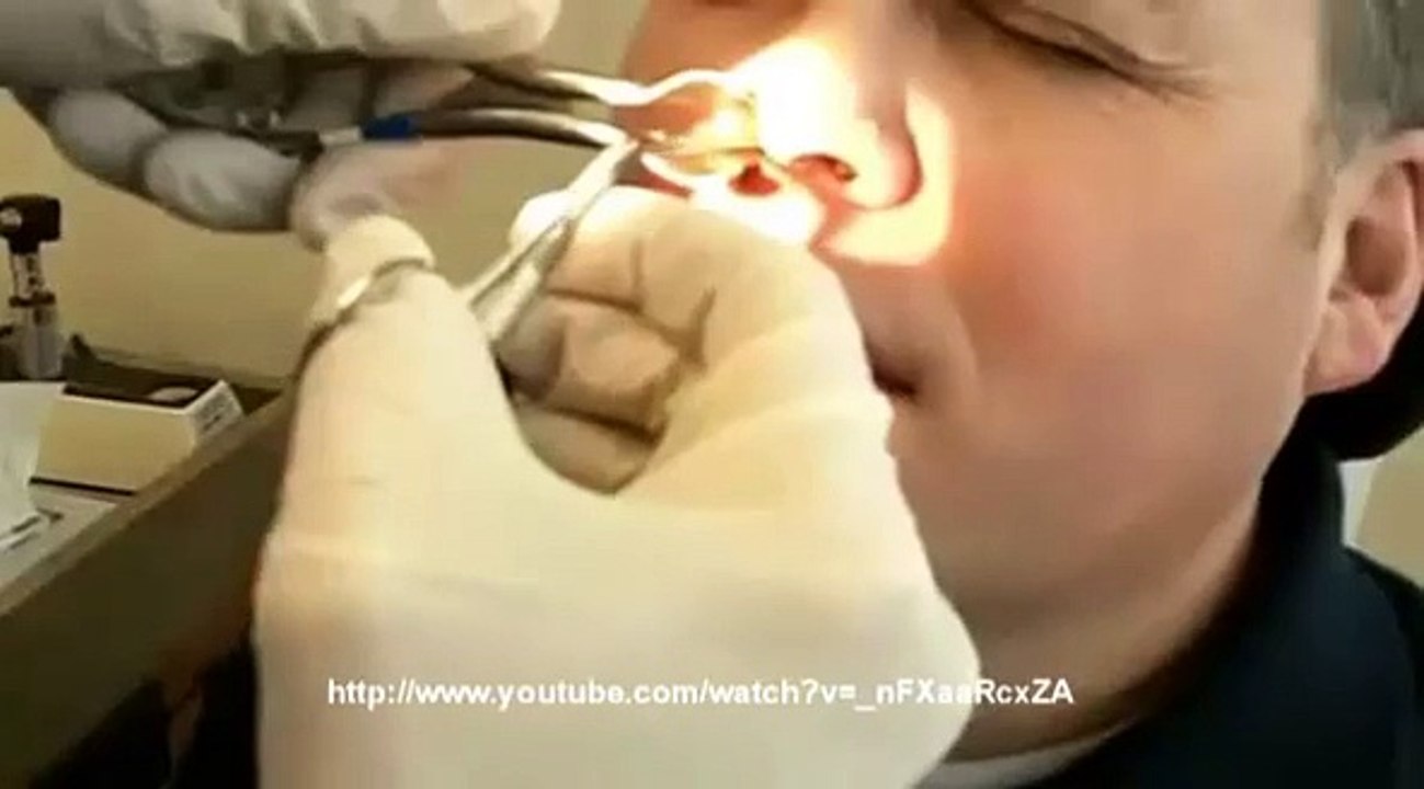 Une crotte de nez....de taille !
