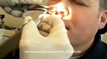 Une crotte de nez....de taille !