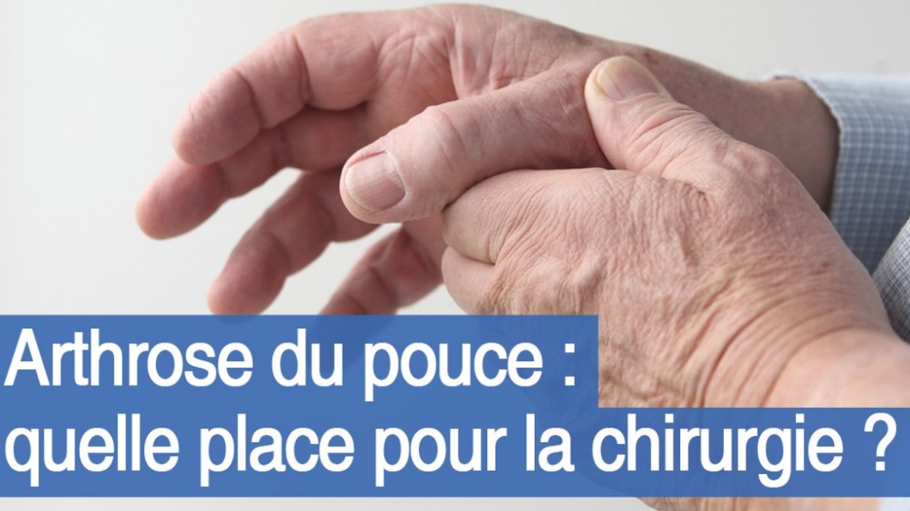 Arthrose du pouce : quelle place pour la chirurgie ?