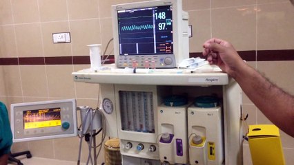 Anesthesia Machine Working Explained By Dr. Tassaduq