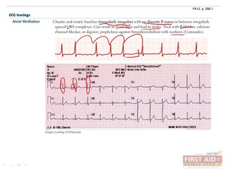 Cardiovascular Anatomy and Physiology Part 4