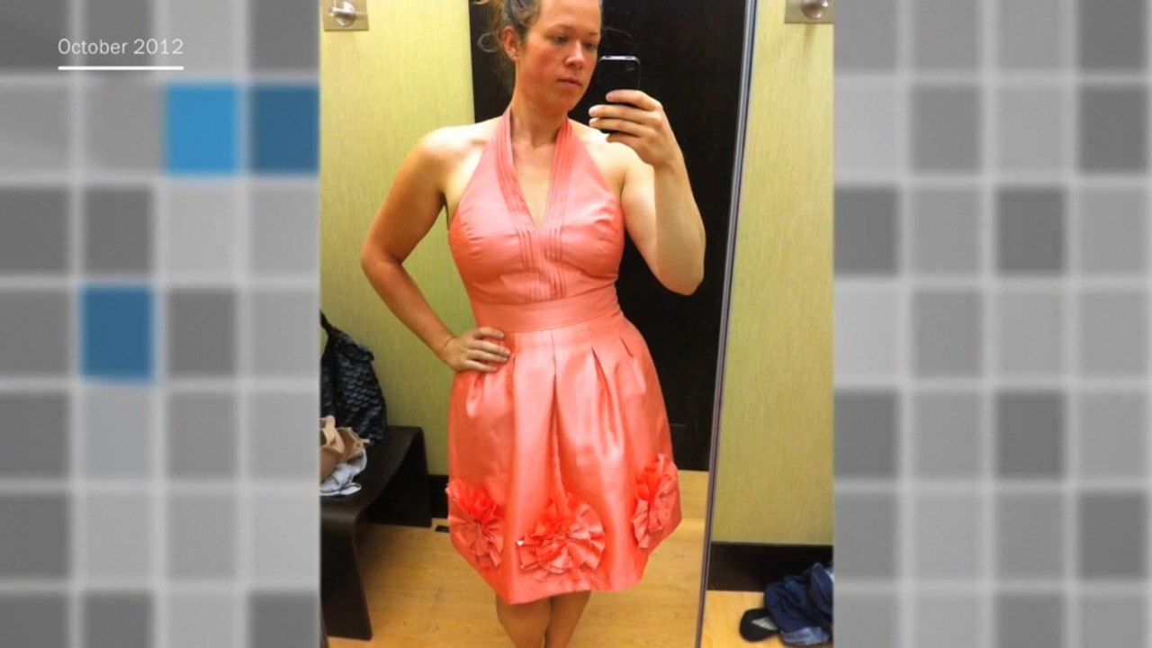 Photos of woman's 160-pound weight loss go viral