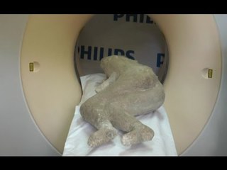 Pompei (NA) - Tac su calchi vittime eruzione: alimentazione sana e denti perfetti (29.09.15)