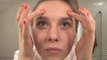 Face Mapping: What your breakouts may reveal