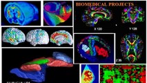 Biomedical project output - 2015 Biomedical Projects