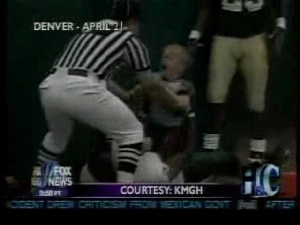 4 year old  Child Injured in foodball