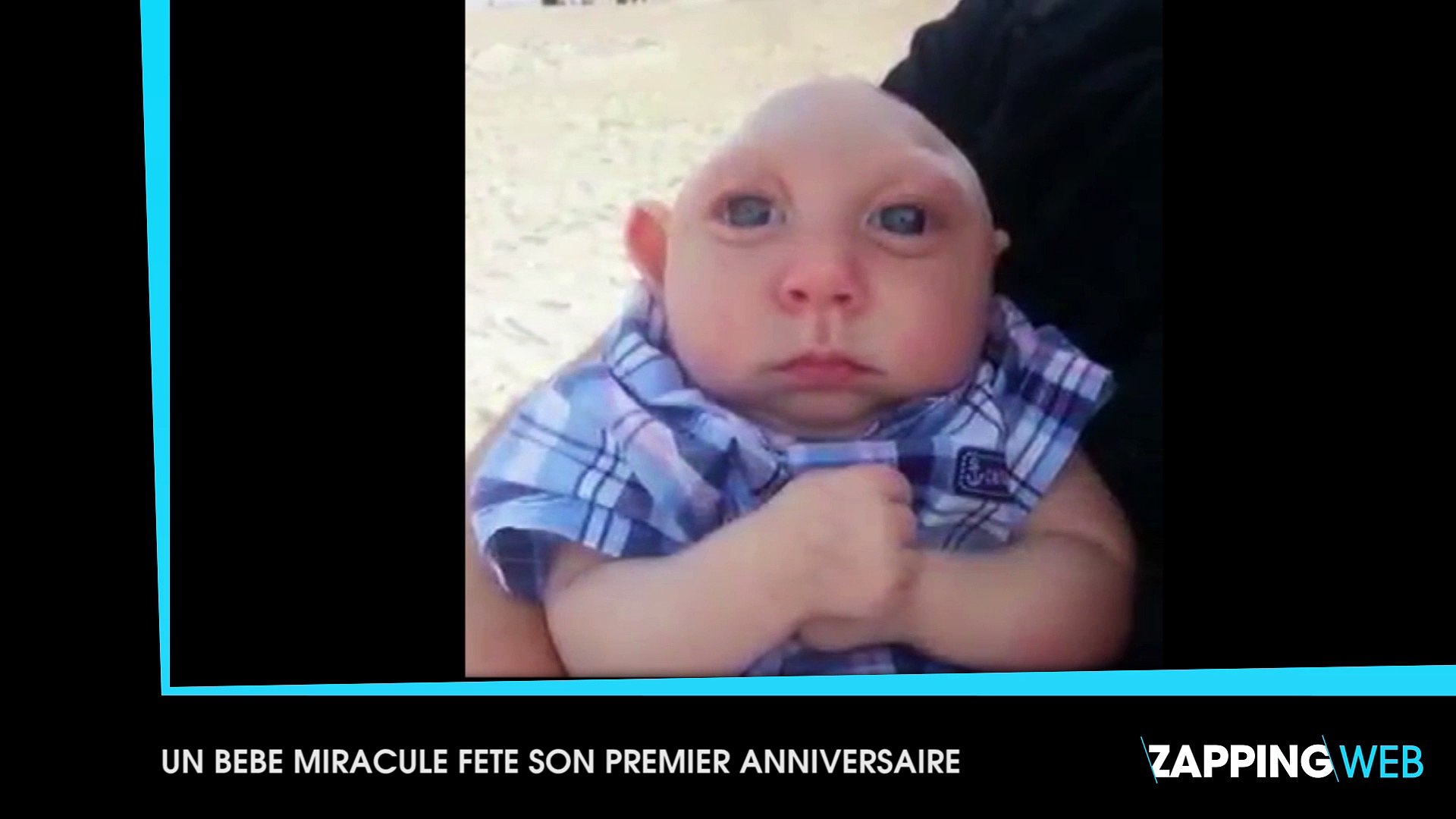Malgre Les Pronostics Des Medecins Un Bebe Atteint D Une Rare Malformation Fete Son Premier Anniversaire Video Dailymotion