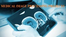 Medical Image Processing Project output - Medical Projects