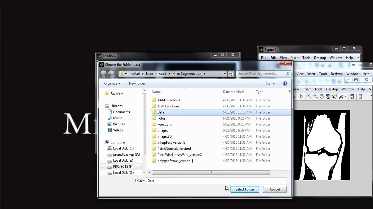 Medical Imaging Project output - Medical Imaging Project
