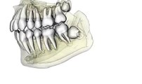 Cone beam computed tomography