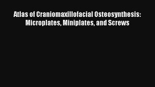 Read Atlas of Craniomaxillofacial Osteosynthesis: Microplates Miniplates and Screws PDF Online