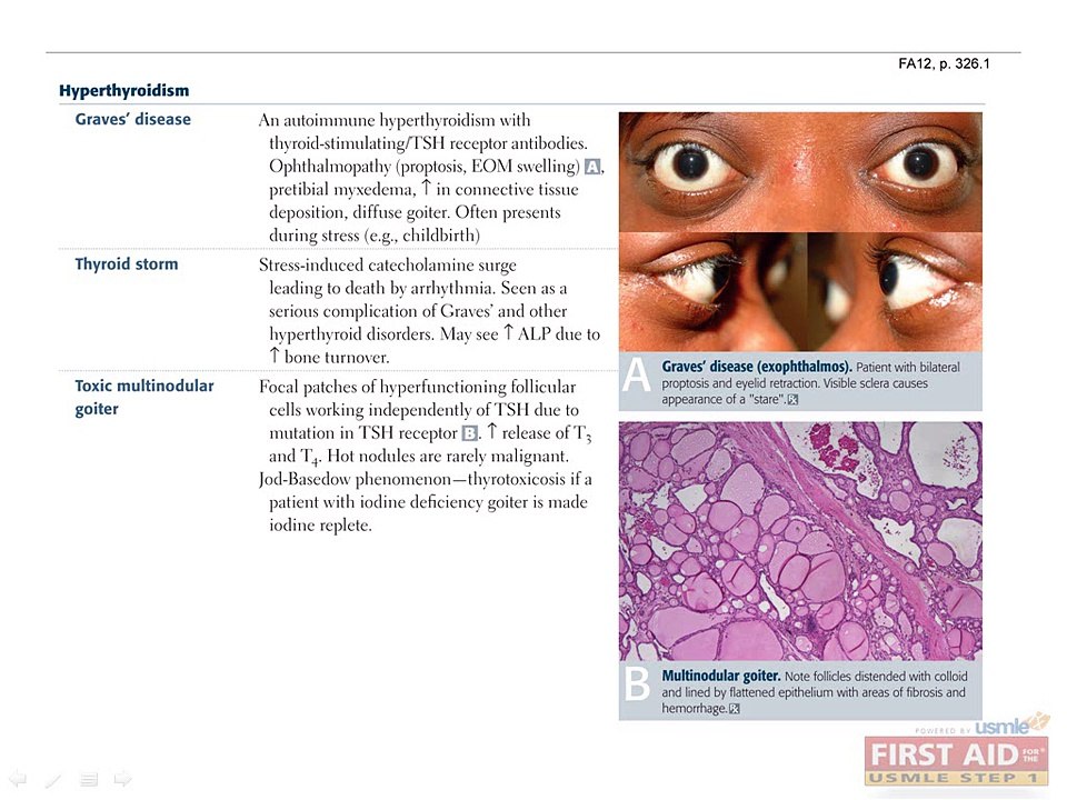 Endocrine Pathology Part 2