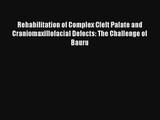 Read Rehabilitation of Complex Cleft Palate and Craniomaxillofacial Defects: The Challenge