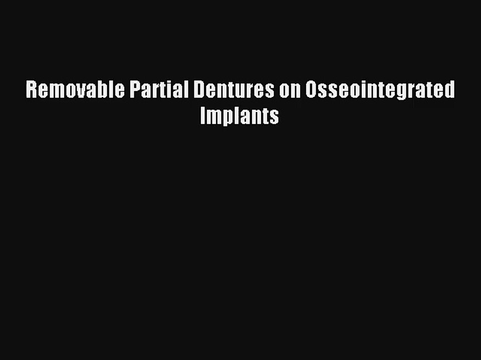 Read Removable Partial Dentures on Osseointegrated Implants Ebook Online