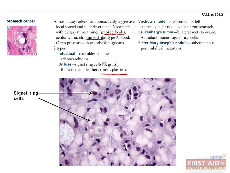 Gastrointestinal Pathology Part 2