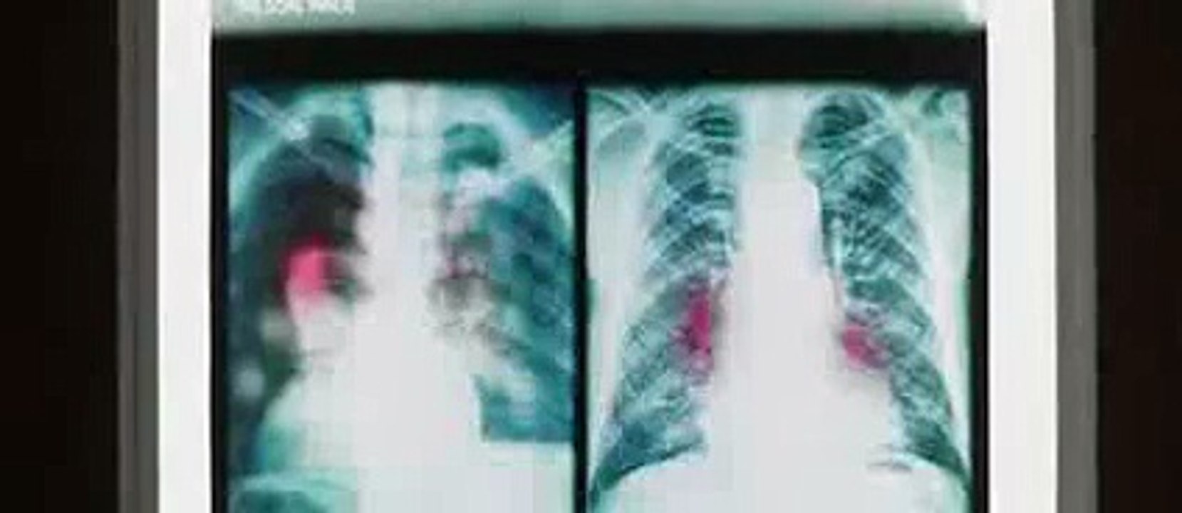 Deadpool Official Trailer 1 2016 Ryan Reynolds Movie