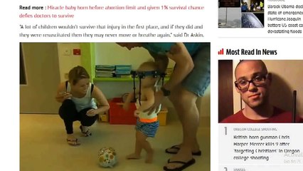 Medical Miracle As Doctors Reattach Head Of A Toddler 'Decapitated’ In Horrific Car Crash