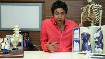 Skolyoz tanısı konulduktan sonra izlenen yol nedir? - DOÇ. DR. MEHMET AYDOĞAN