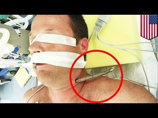 자전거를 타다, 나뭇가지가 목에 박혀버린 남성, 스스로 자전거 다시 타고 뚜벅뚜벅 병원 행