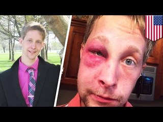 아스퍼거 증후군을 가진 한 10대, 자신을 괴롭힌 학생들에게 리포트를 쓰게 해