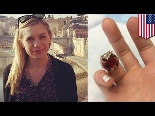 한 스웨덴 여성, 경찰마가 자신의 손가락을 물어뜯었다며, 뉴욕시 경찰을 고소해