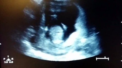 Clap your hands, baby announcement