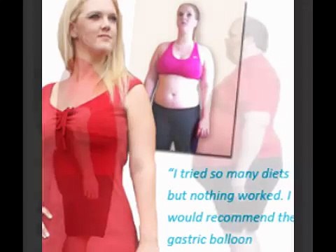 bariatric stomach balloon weight loss