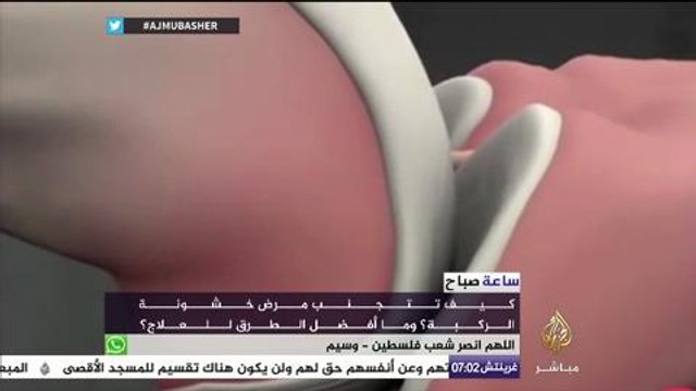 خشونة مفاصل الركبة هل هو مقترن بالتقدم في السن ؟ - ساعة صباح