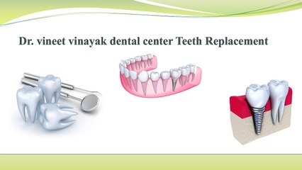 Dr. vineet vinayak dental center Teeth Replacement Options