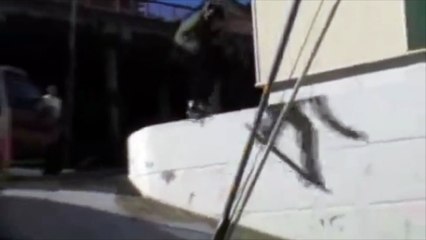 Omg brutal ! This is the worst pain ever !