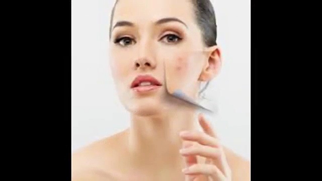 Pimple Treatment – Acne Treatment – Acne Scar Treatment