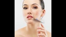 Pimple Treatment - Acne Treatment - Acne Scar Treatment