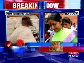 Employer Chopped Hand of Indian Employee | Ministry Stepped In