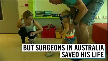 #Surgery re-attached #toddler’s head to neck