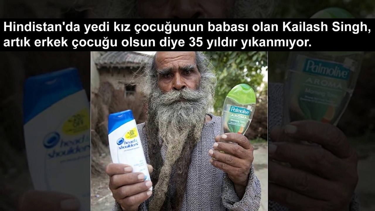 Gerçek Olduğuna İnanamayacağınız 5 Erkek