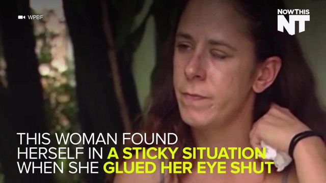 Woman Mistakes SuperGlue For Eye Drops, Glues Her Eye Shut