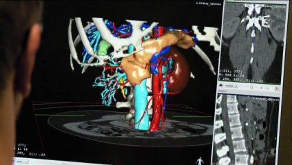 Inventer Demain 2015 : la chirurgie augmentée grâce à la visualisation 3D