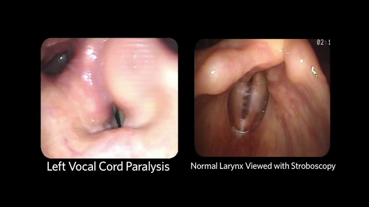 4. The Nasopharynx and Larynx Exam